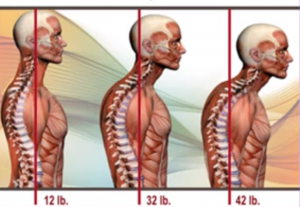 flexion cervical